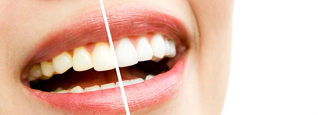 Common dental problems and lifestyle tips for better oral health