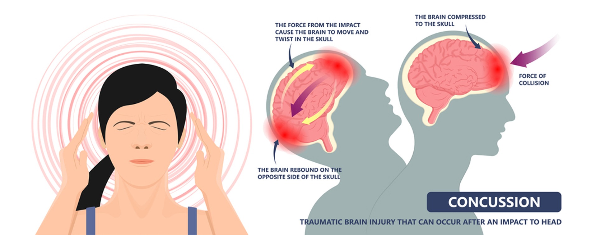 Types of TBI