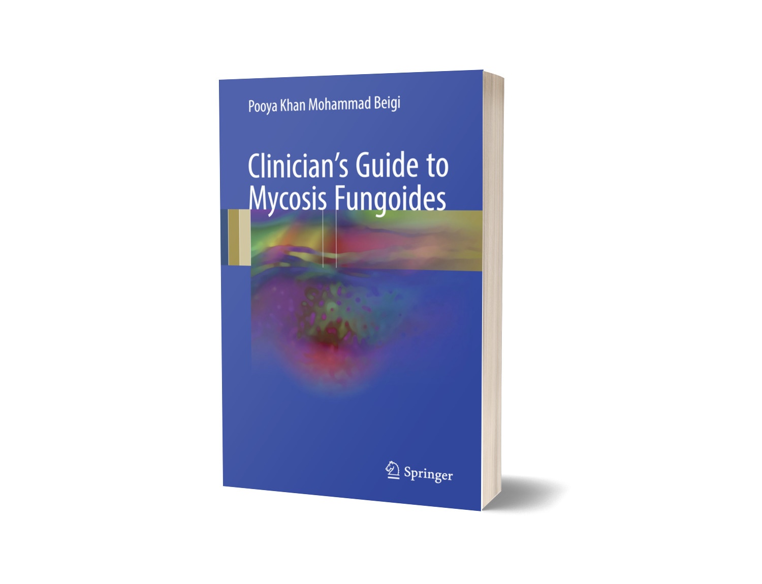 Clinician's Guide to Mycosis Fungoides 1st ed. 2017 Edition, Kindle Edition 