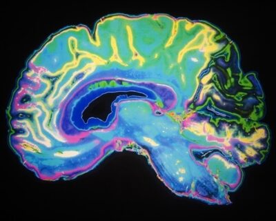 New ‘sniff test’ predicts recovery of consciousness in the brain