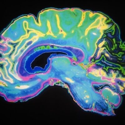 New ‘sniff test’ predicts recovery of consciousness in the brain