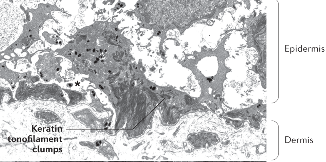 Pathological Features